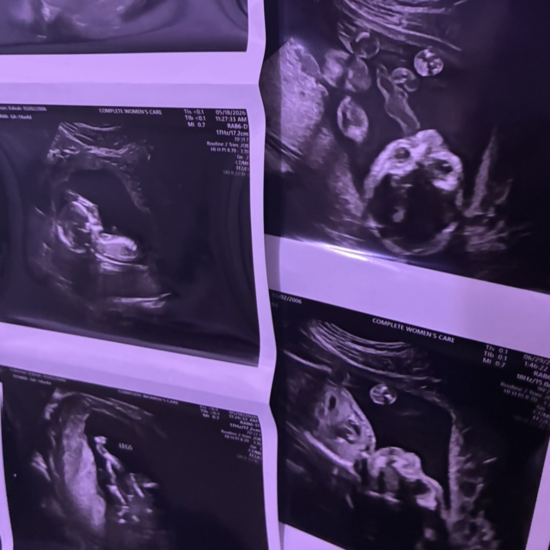 Photo shared by Kaleah for their Babylist baby registry.