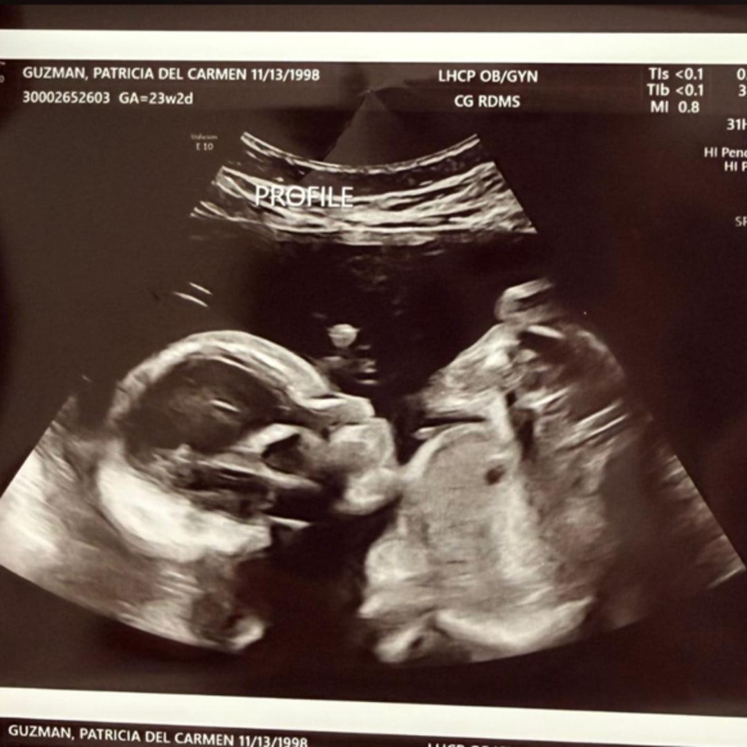 Photo shared by Patricia for their Babylist baby registry.
