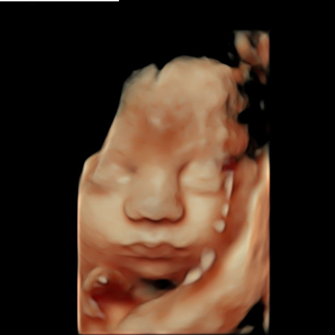 Photo shared by Kayli for their Babylist baby registry.