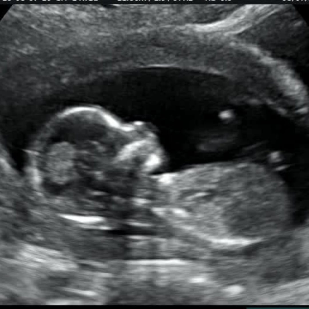 Photo shared by Bowin for their Babylist baby registry.