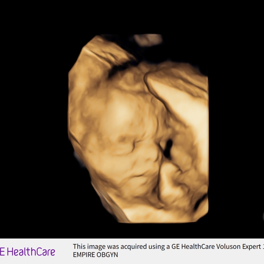 Photo shared by Ariana for their Babylist baby registry.