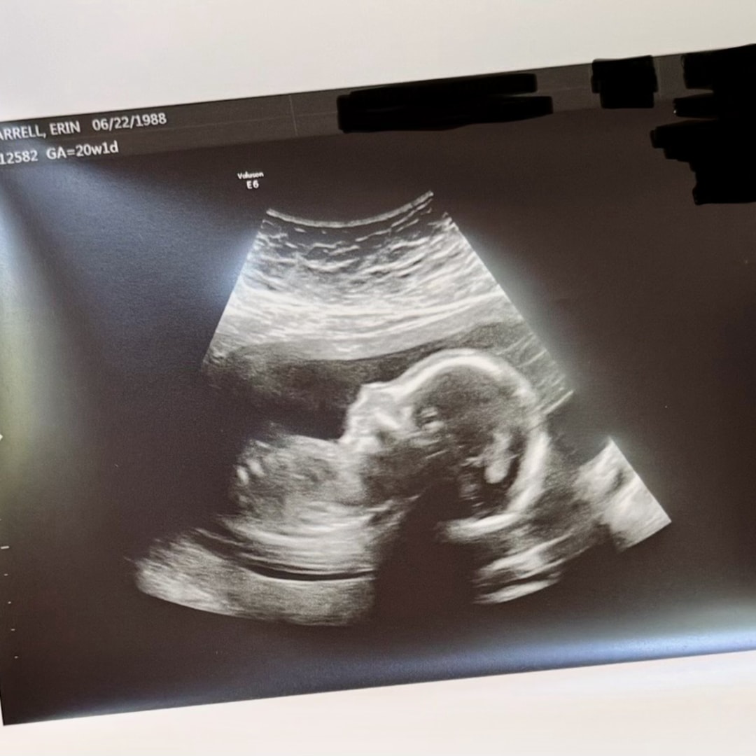 Photo shared by Erin for their Babylist baby registry.