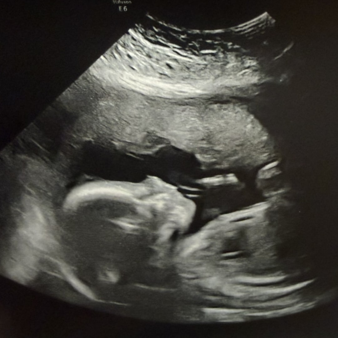 Photo shared by Tabitha for their Babylist baby registry.