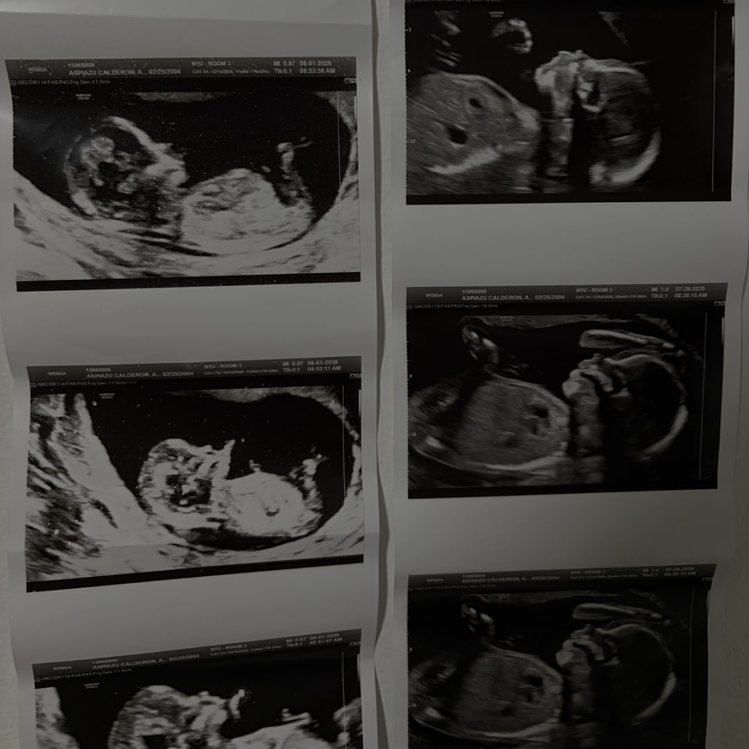 Photo shared by Annette for their Babylist baby registry.