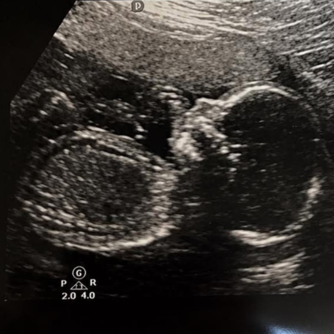 Photo shared by Allison for their Babylist baby registry.