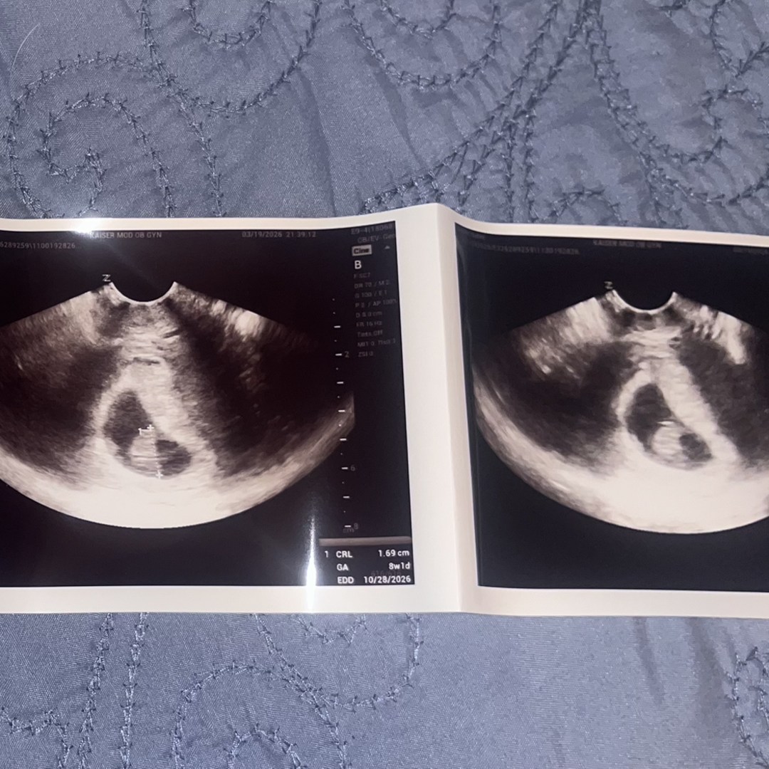 Photo shared by Isabel for their Babylist baby registry.