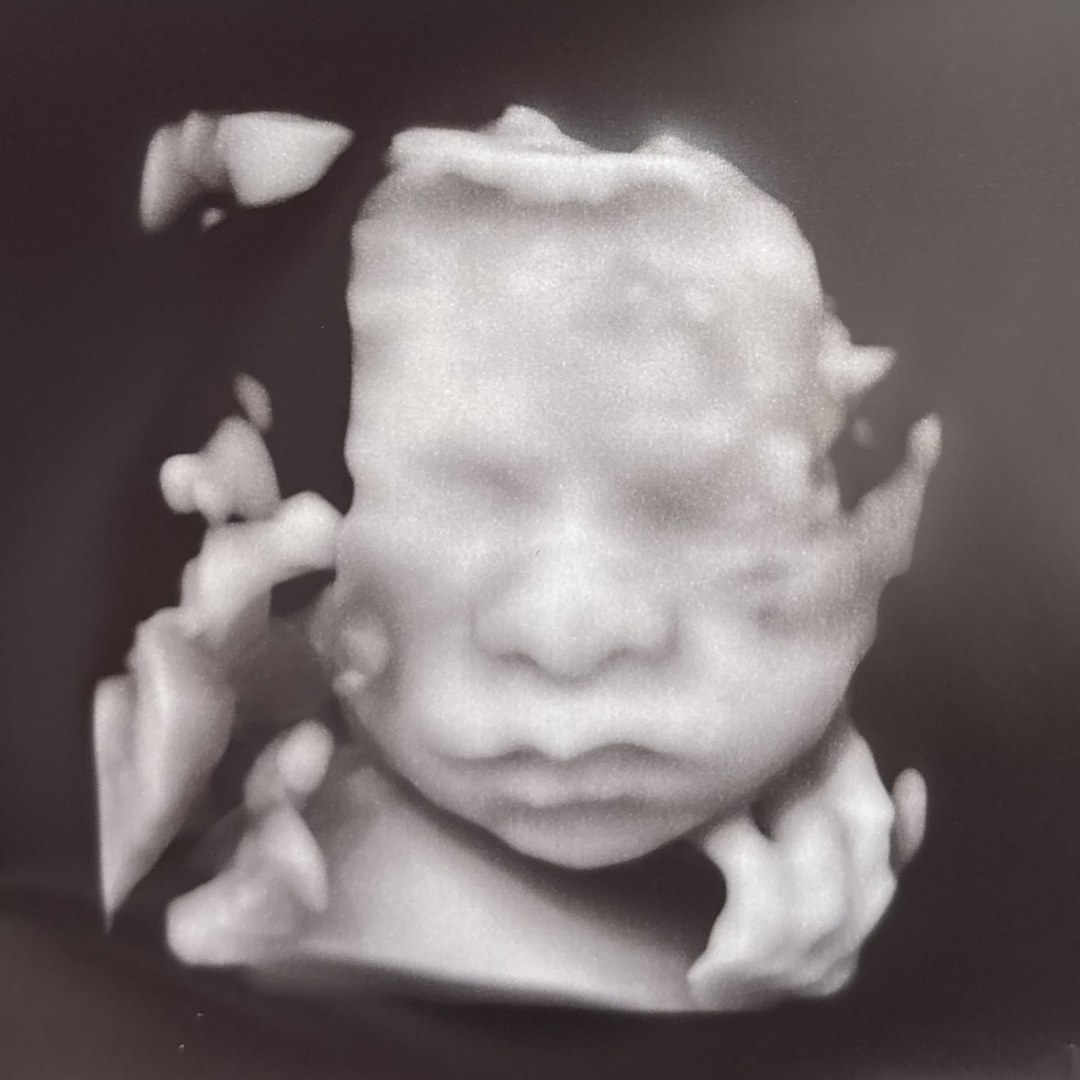 Photo shared by Alexis for their Babylist baby registry.