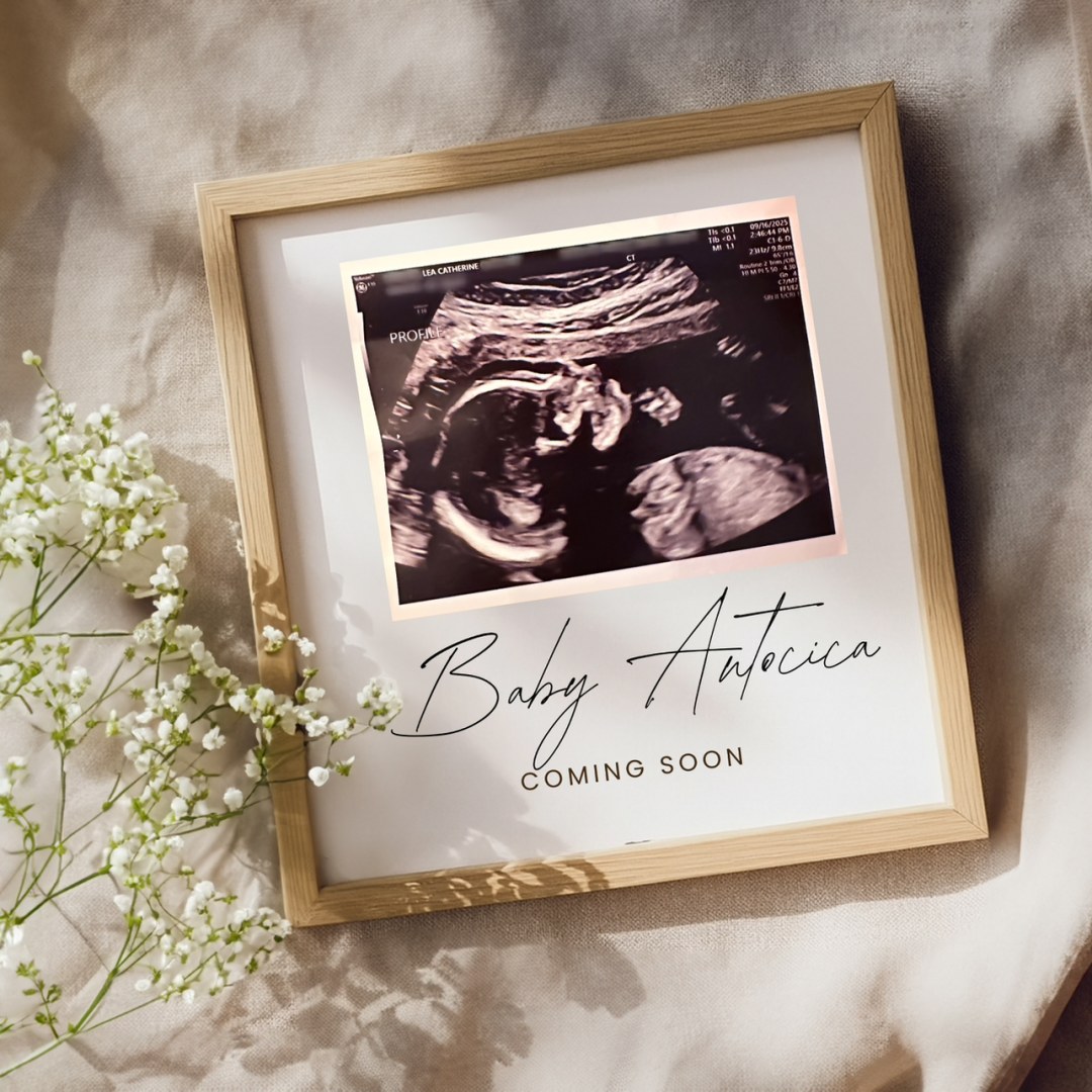 Photo shared by Lea Catherine for their Babylist baby registry.