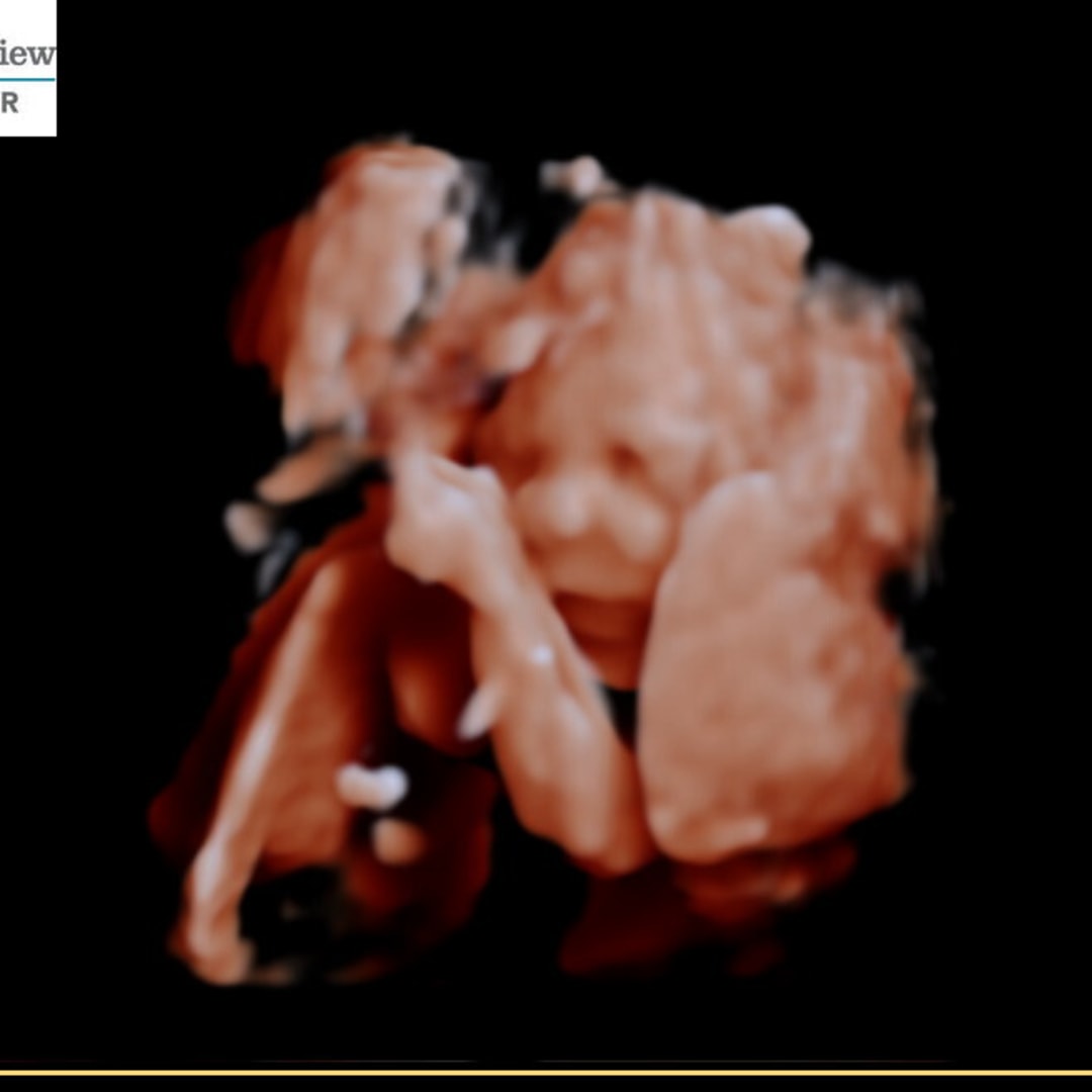 Photo shared by Grace for their Babylist baby registry.