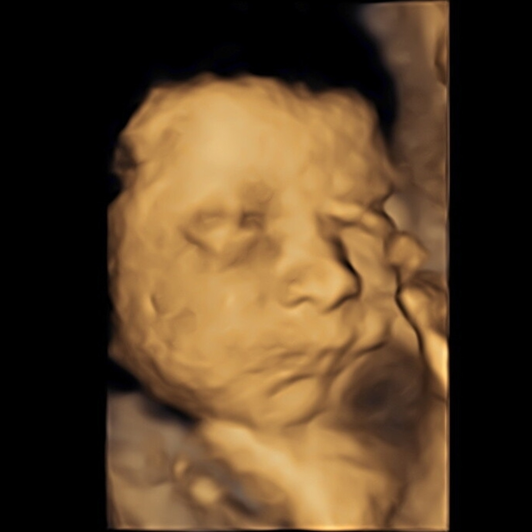 Photo shared by Kristen for their Babylist baby registry.