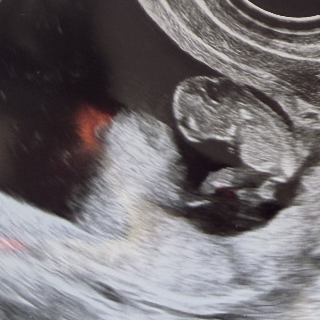 Photo shared by Jose for their Babylist baby registry.