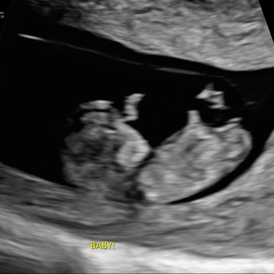 Photo shared by Amanda for their Babylist baby registry.