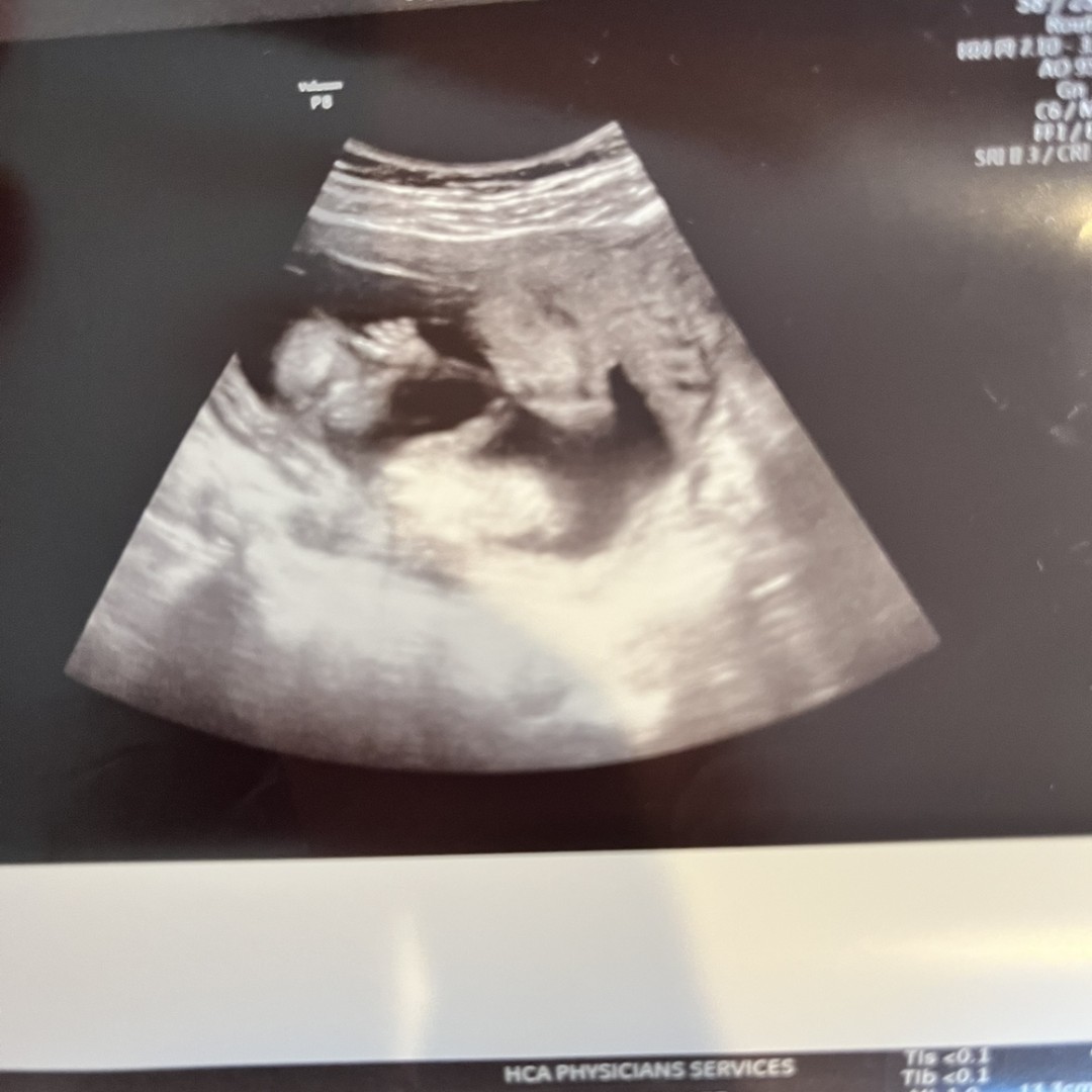 Photo shared by Jacqueline for their Babylist baby registry.