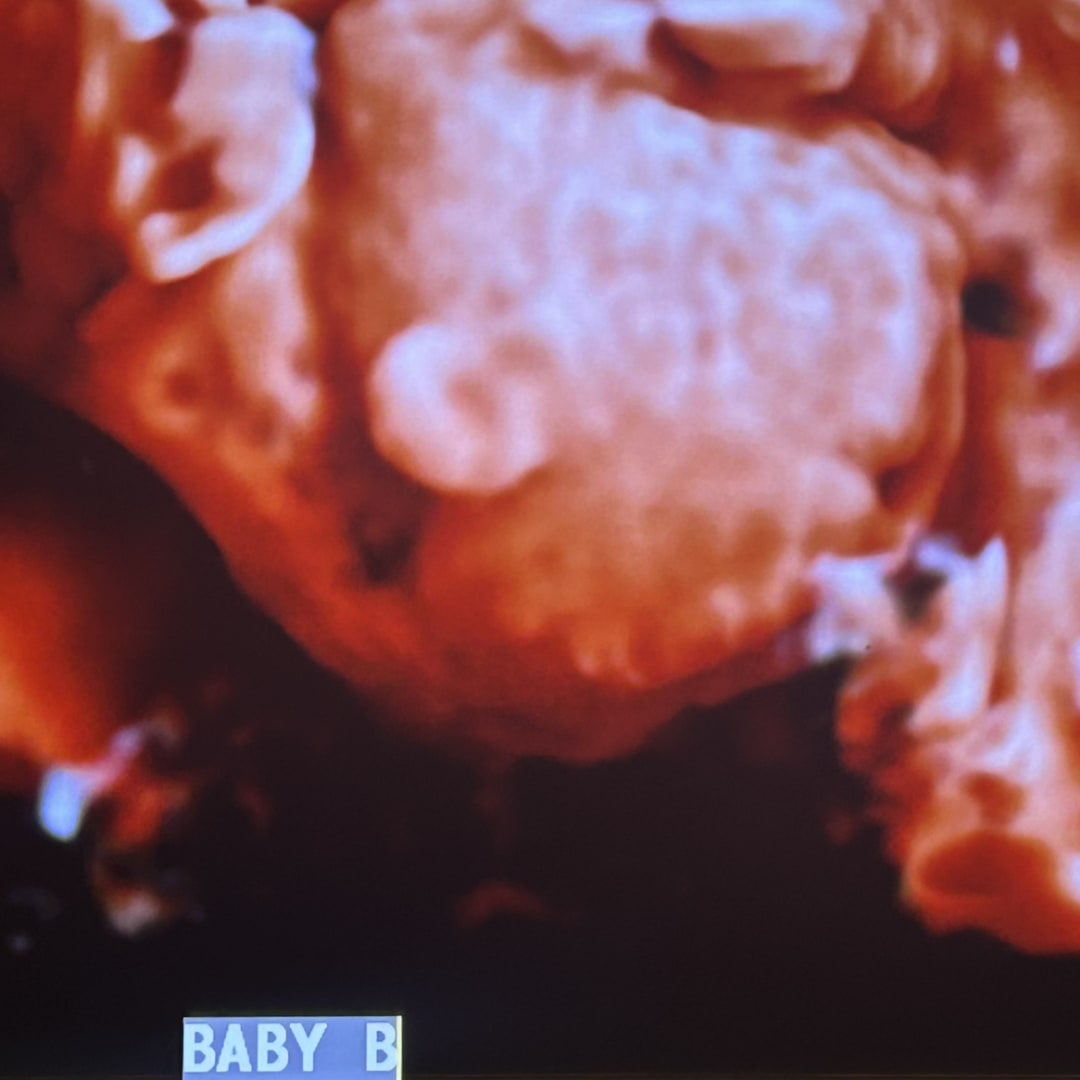 Photo shared by Lileigh for their Babylist baby registry.