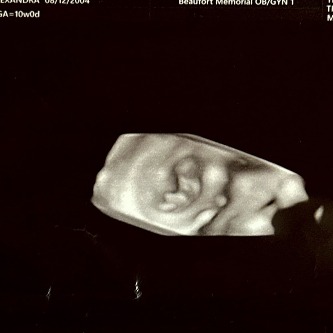 Photo shared by Alexandra for their Babylist baby registry.