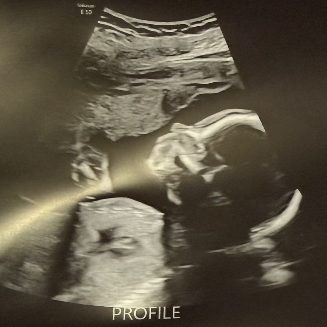 Photo shared by Chelsea and Courtney for their Babylist baby registry.