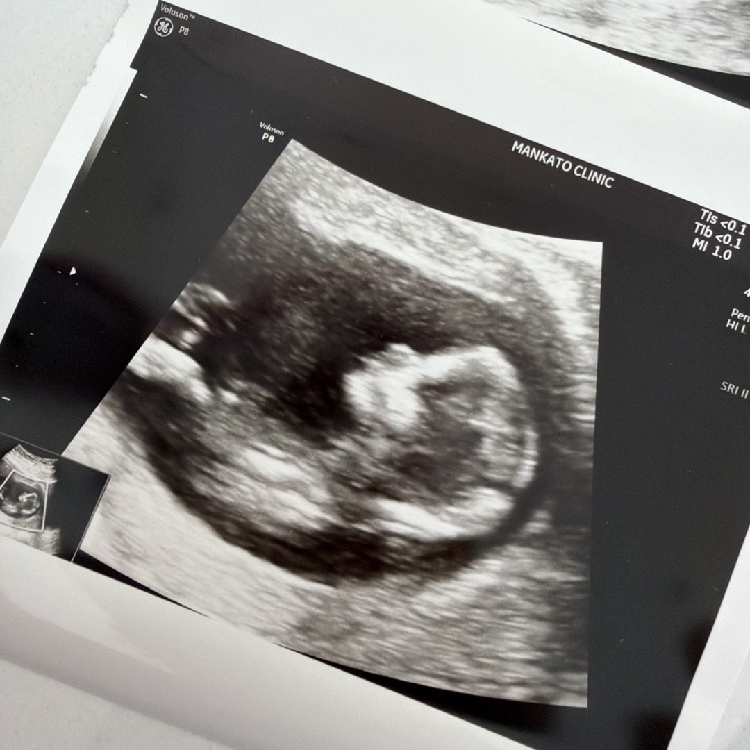 Photo shared by Cate for their Babylist baby registry.