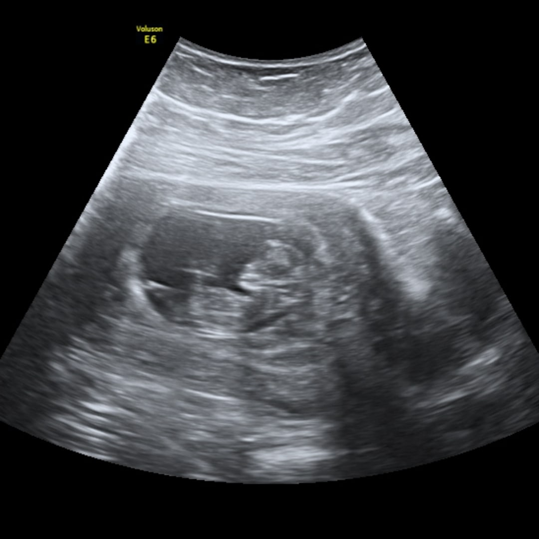 Photo shared by Noemi for their Babylist baby registry.