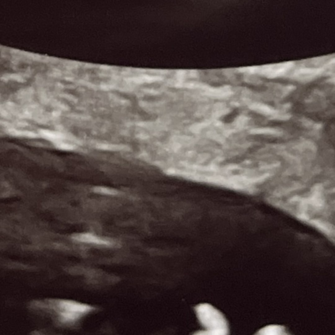 Photo shared by Patrina for their Babylist baby registry.