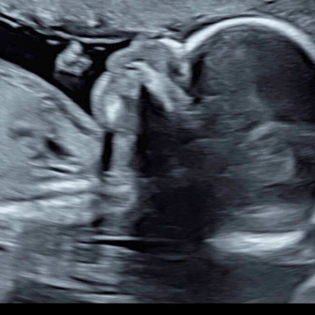 Photo shared by Azure for their Babylist baby registry.