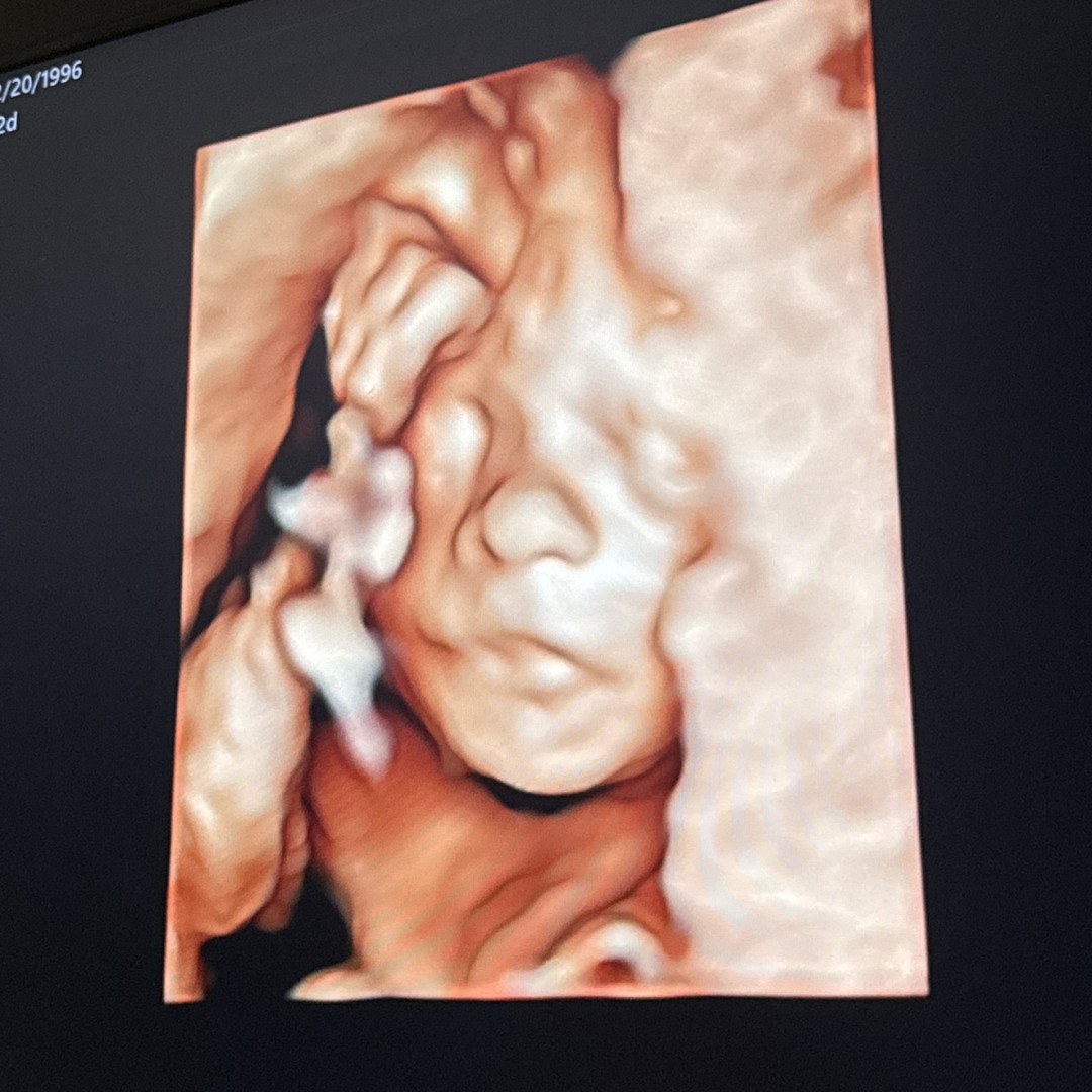 Photo shared by Megan for their Babylist baby registry.