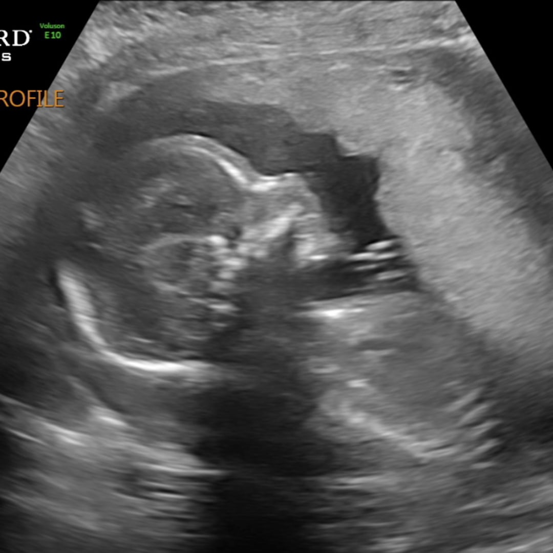 Photo shared by Jacie for their Babylist baby registry.