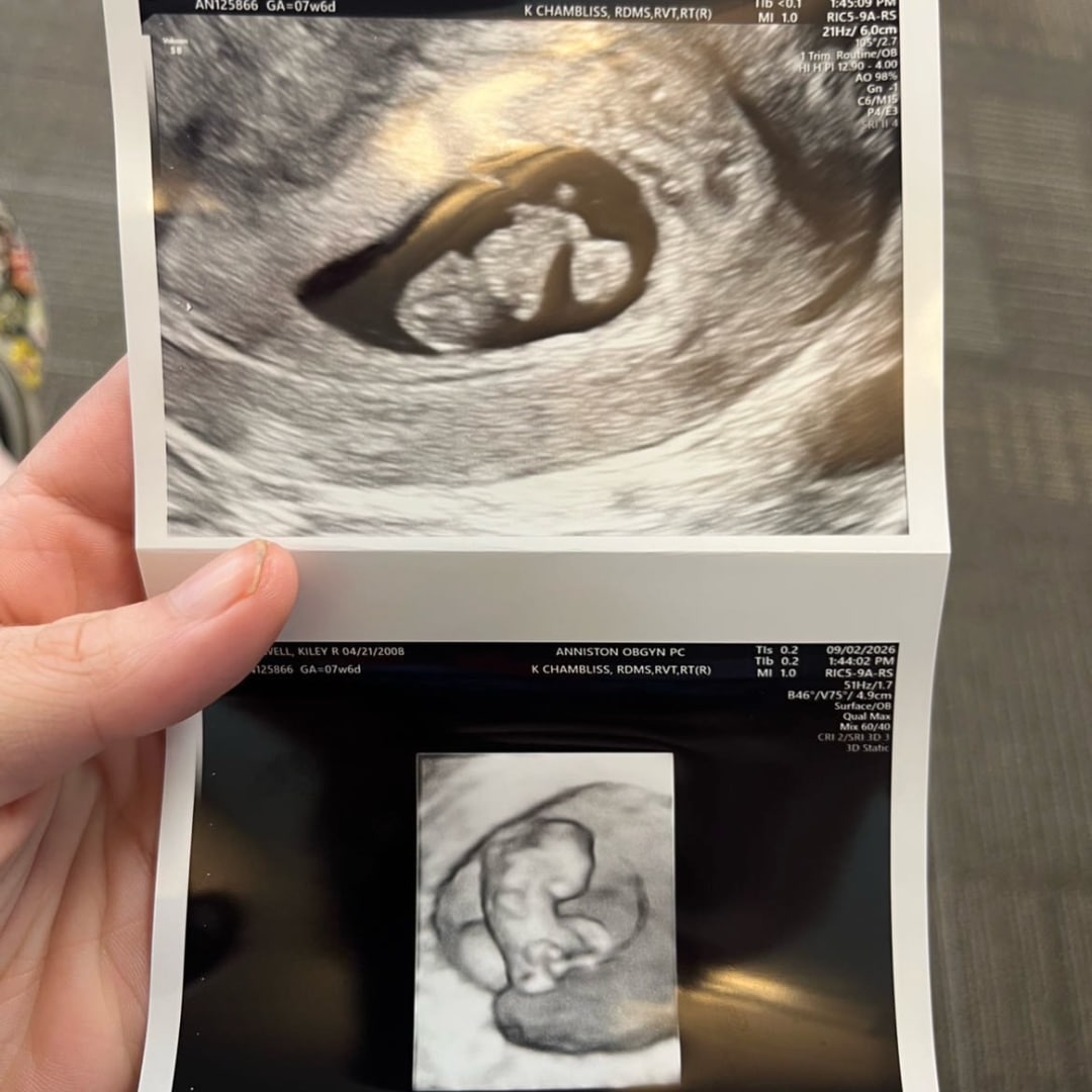 Photo shared by Kiley for their Babylist baby registry.