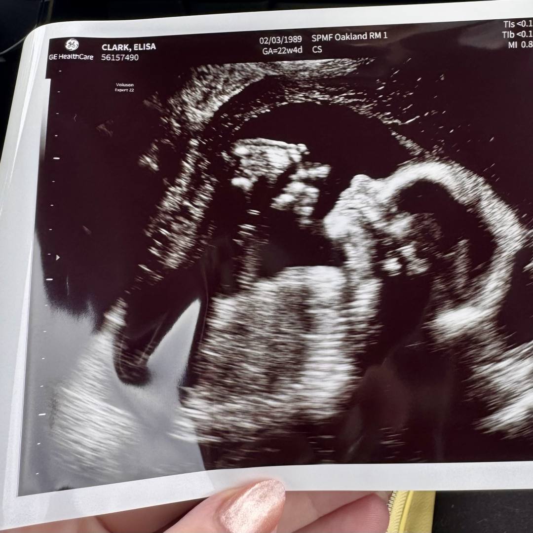 Photo shared by Lisie for their Babylist baby registry.