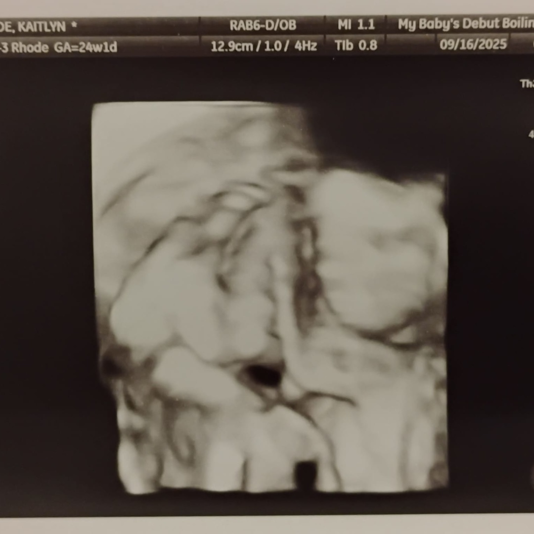 Photo shared by Kaitlyn for their Babylist baby registry.