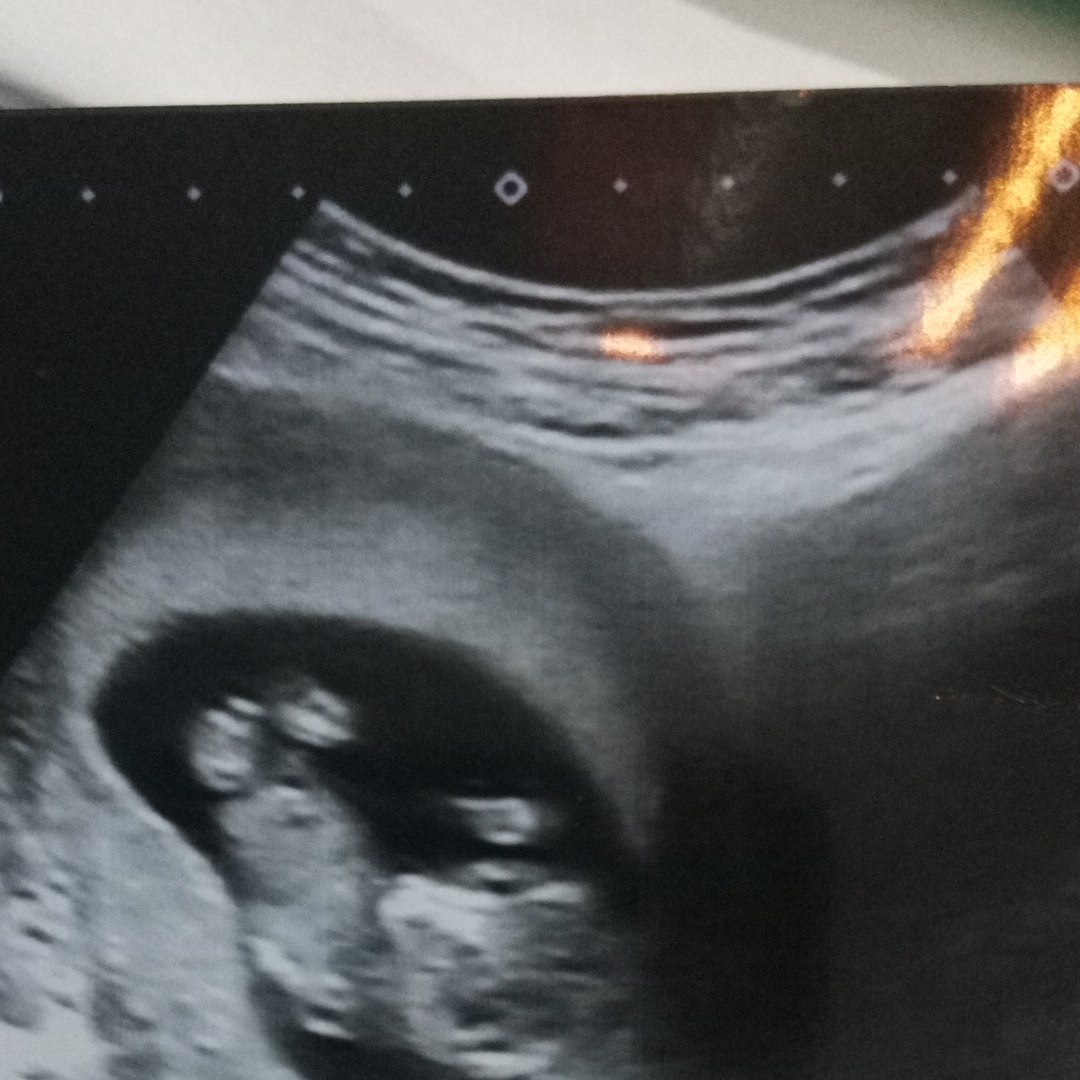 Photo shared by Yudit for their Babylist baby registry.