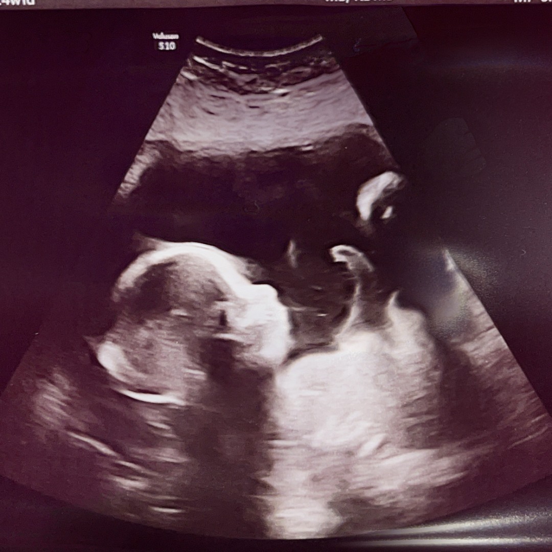 Photo shared by Haley for their Babylist baby registry.