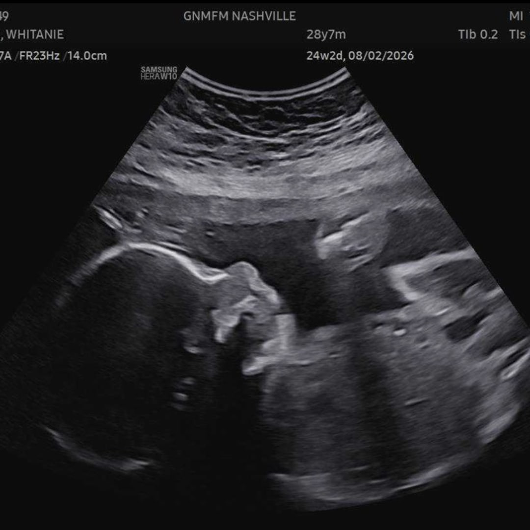 Photo shared by Whitanie for their Babylist baby registry.