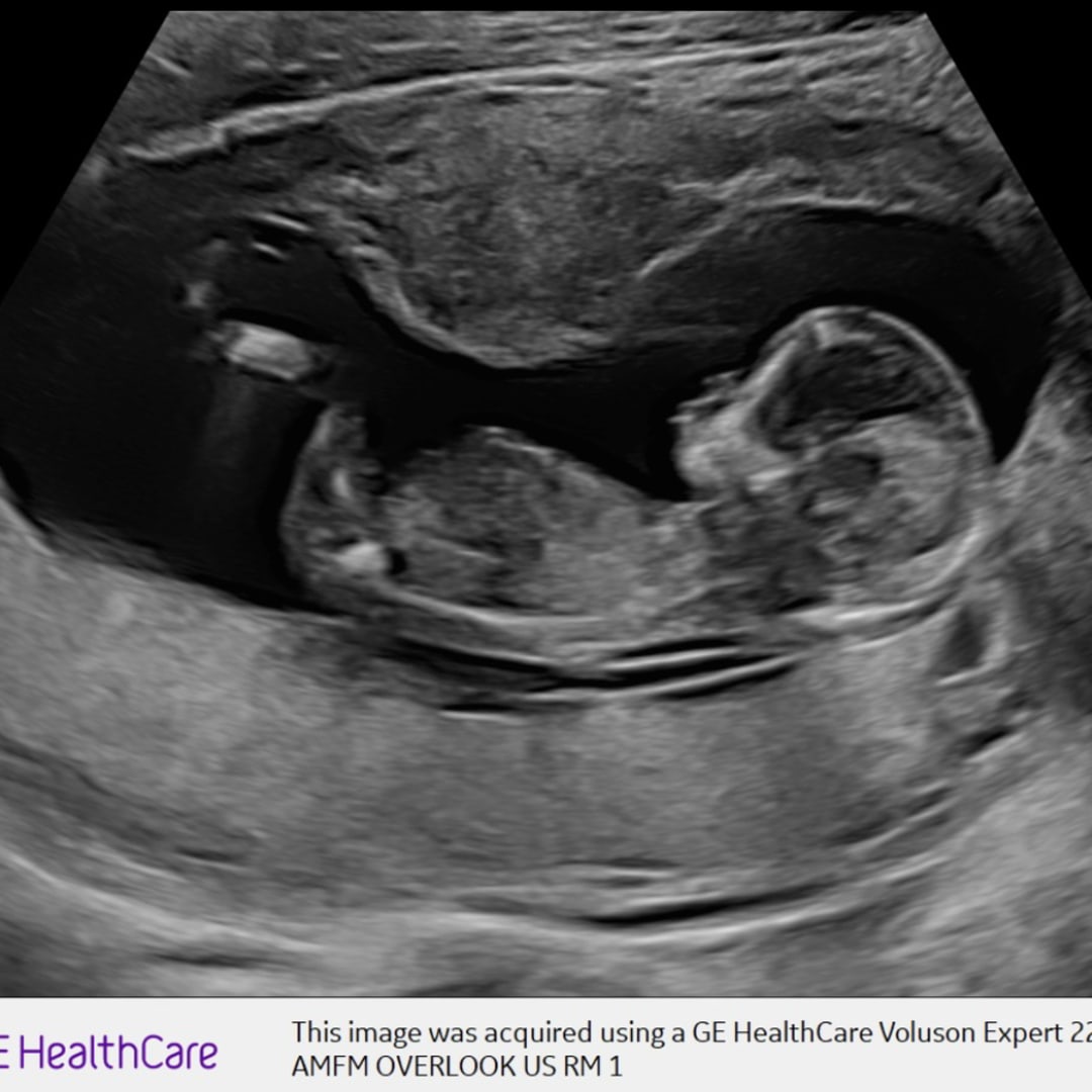 Photo shared by Brianna for their Babylist baby registry.