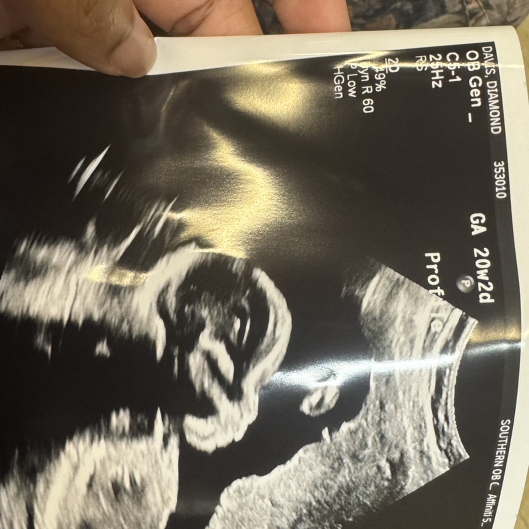 Photo shared by Diamond for their Babylist baby registry.