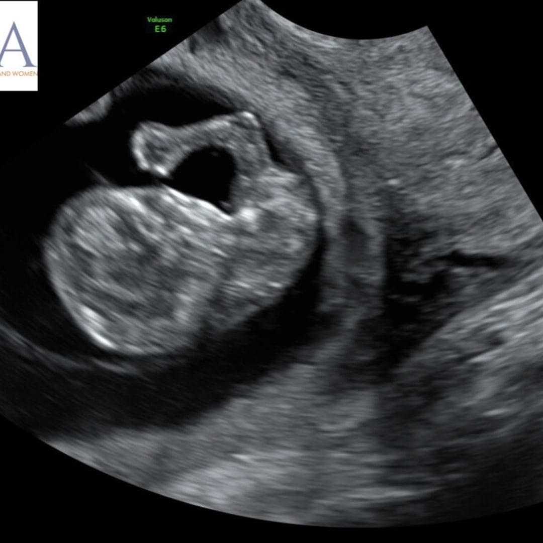 Photo shared by Rebecca for their Babylist baby registry.