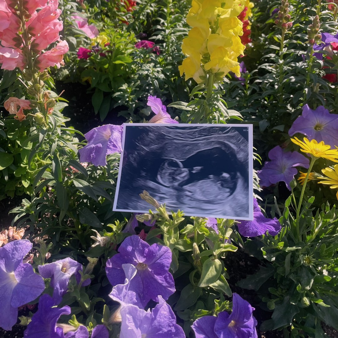 Photo shared by Hanna for their Babylist baby registry.
