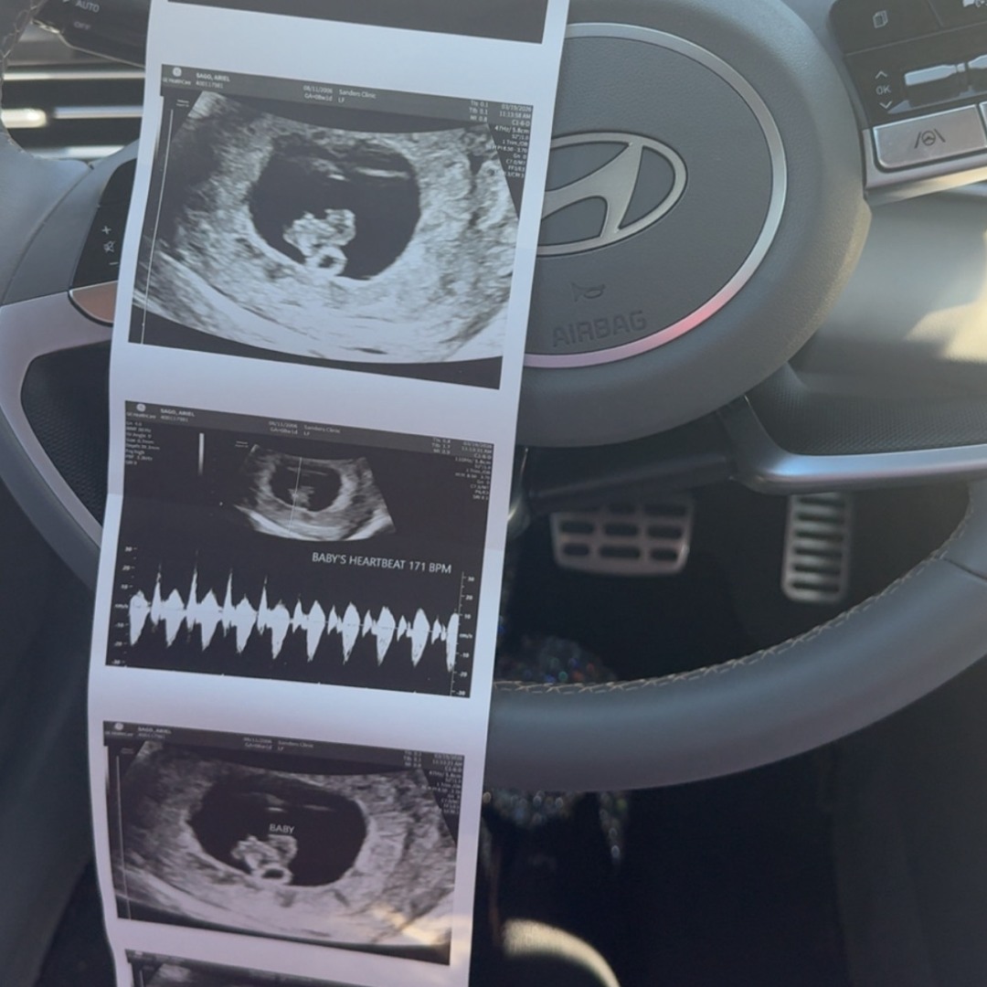 Photo shared by Ariel for their Babylist baby registry.