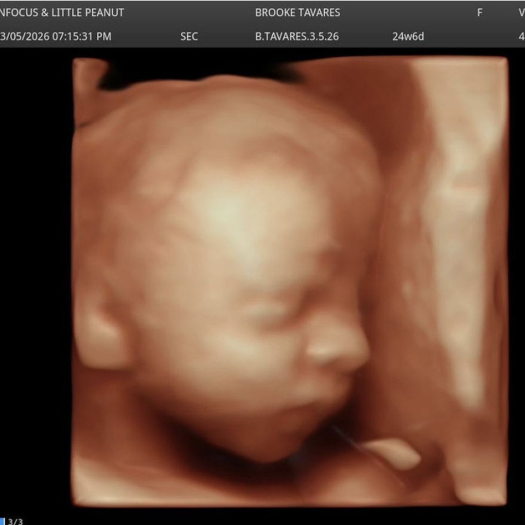 Photo shared by Brooke for their Babylist baby registry.