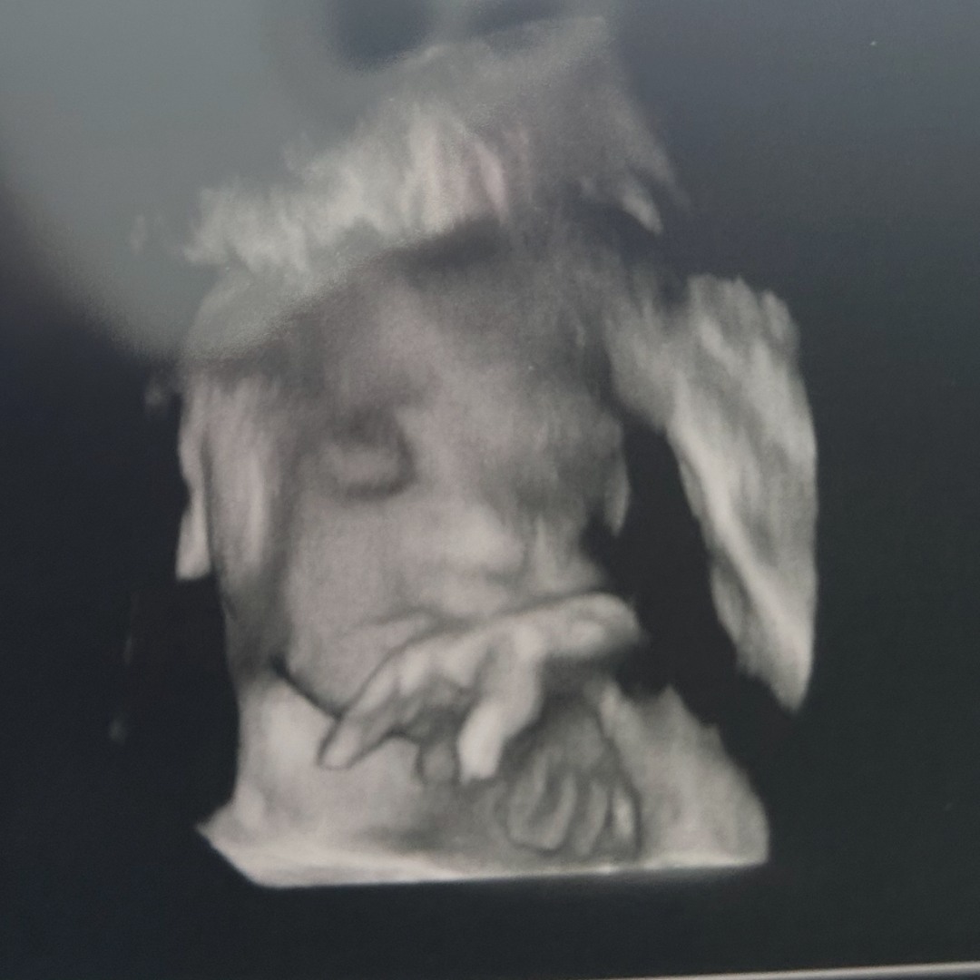 Photo shared by Payton for their Babylist baby registry.