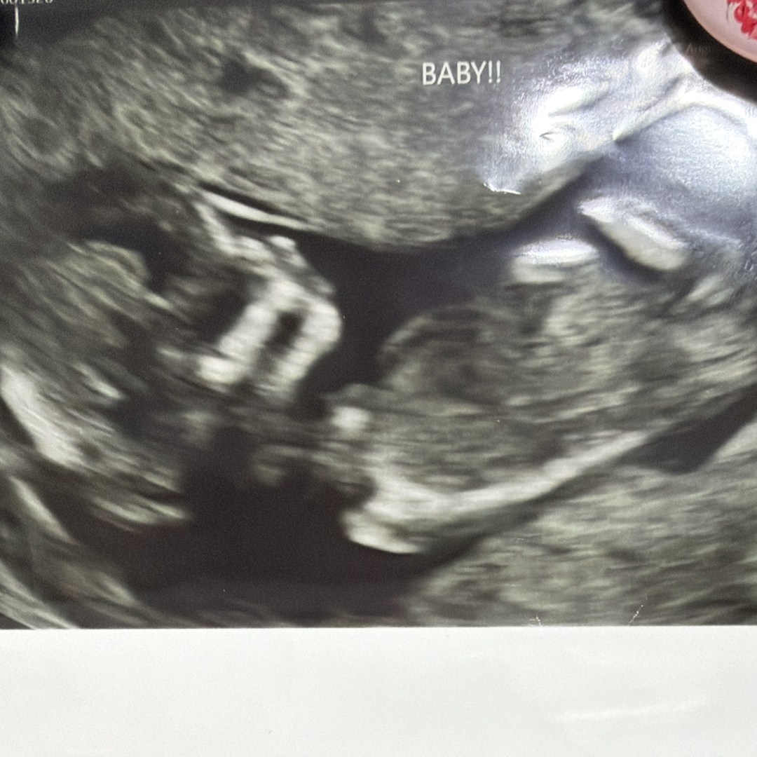 Photo shared by Courtney for their Babylist baby registry.