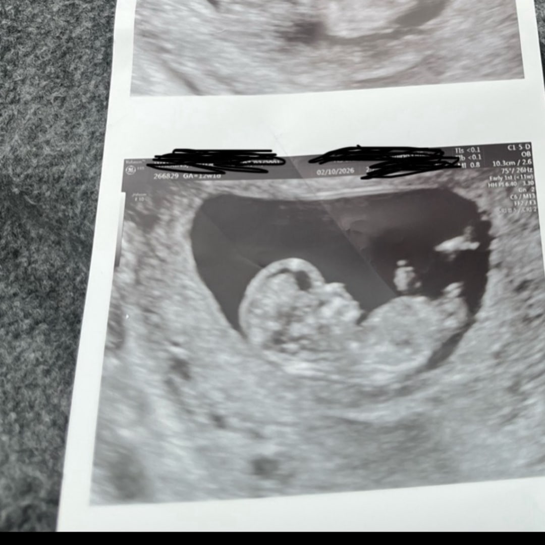 Photo shared by Antoenesha for their Babylist baby registry.
