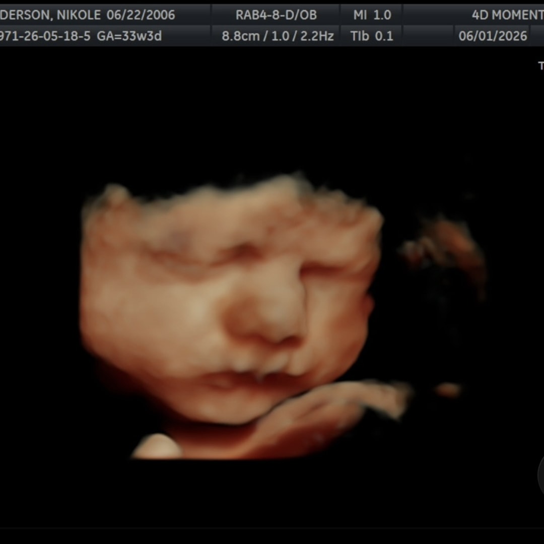 Photo shared by Nikole for their Babylist baby registry.