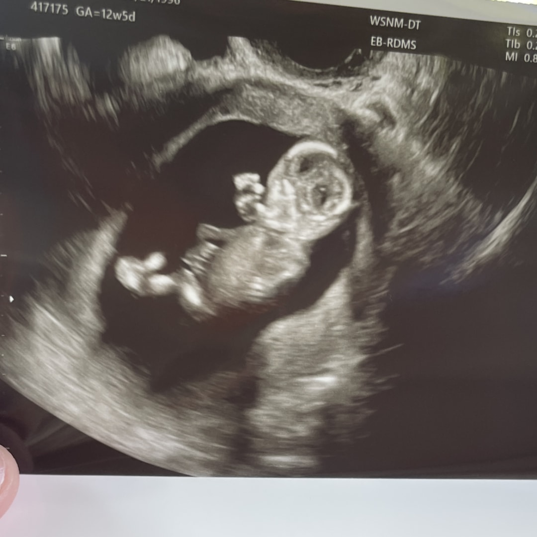 Photo shared by Mia for their Babylist baby registry.