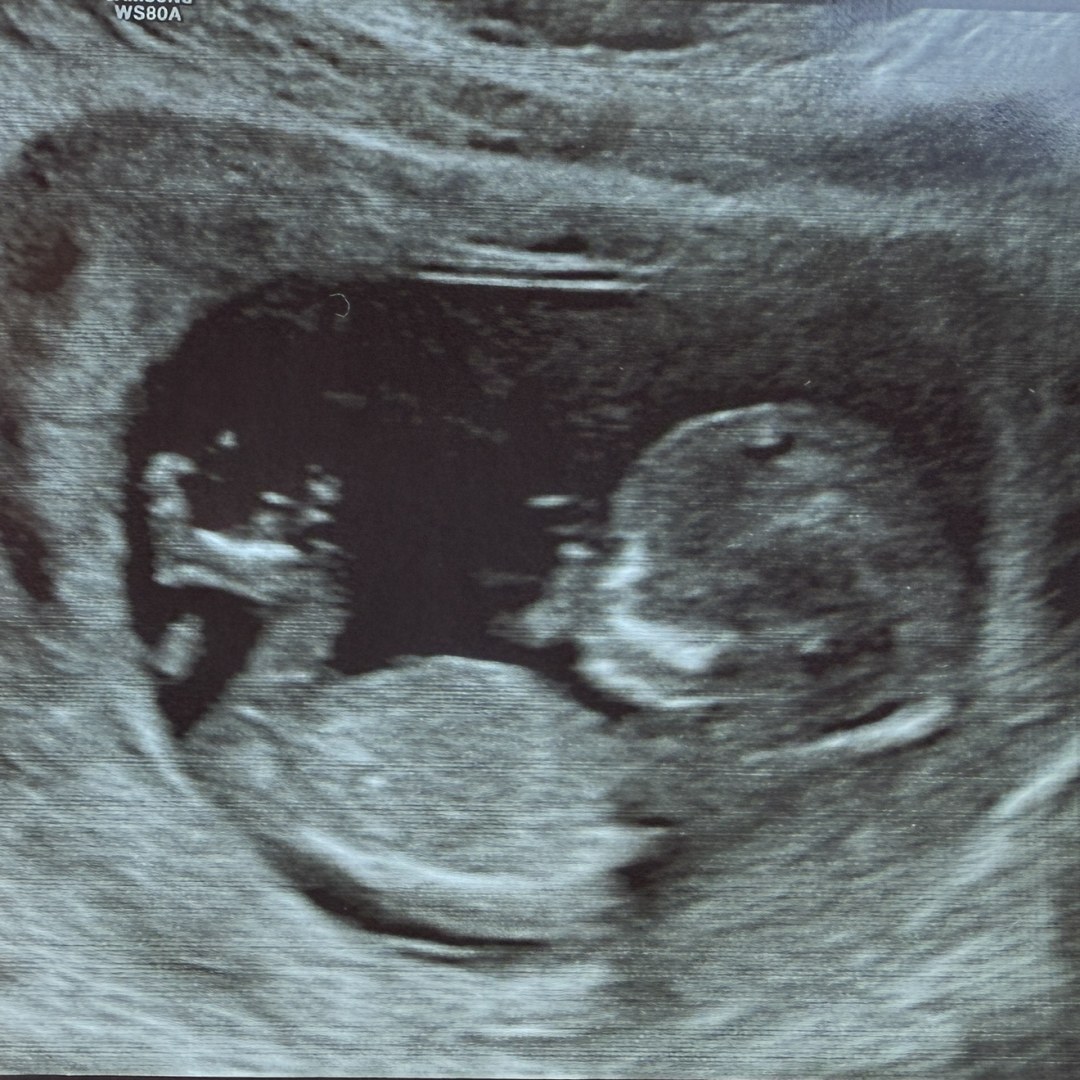 Photo shared by Taylor Anne for their Babylist baby registry.