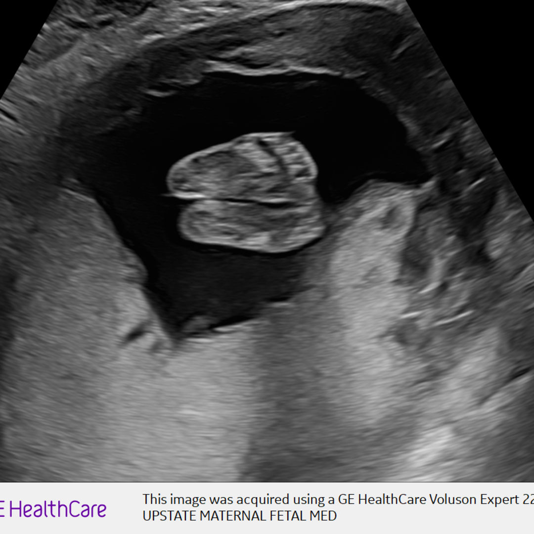 Photo shared by Stephanie for their Babylist baby registry.