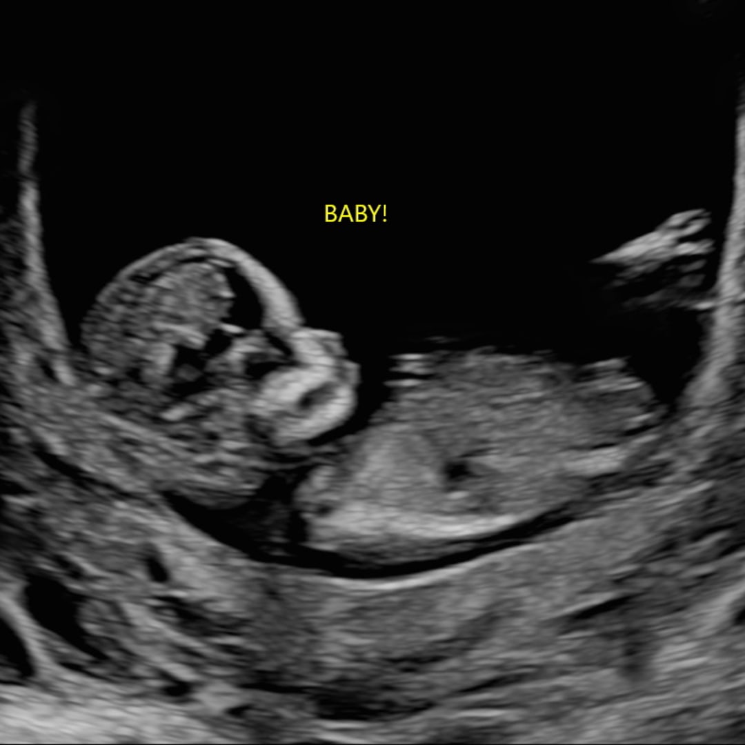 Photo shared by Grace for their Babylist baby registry.