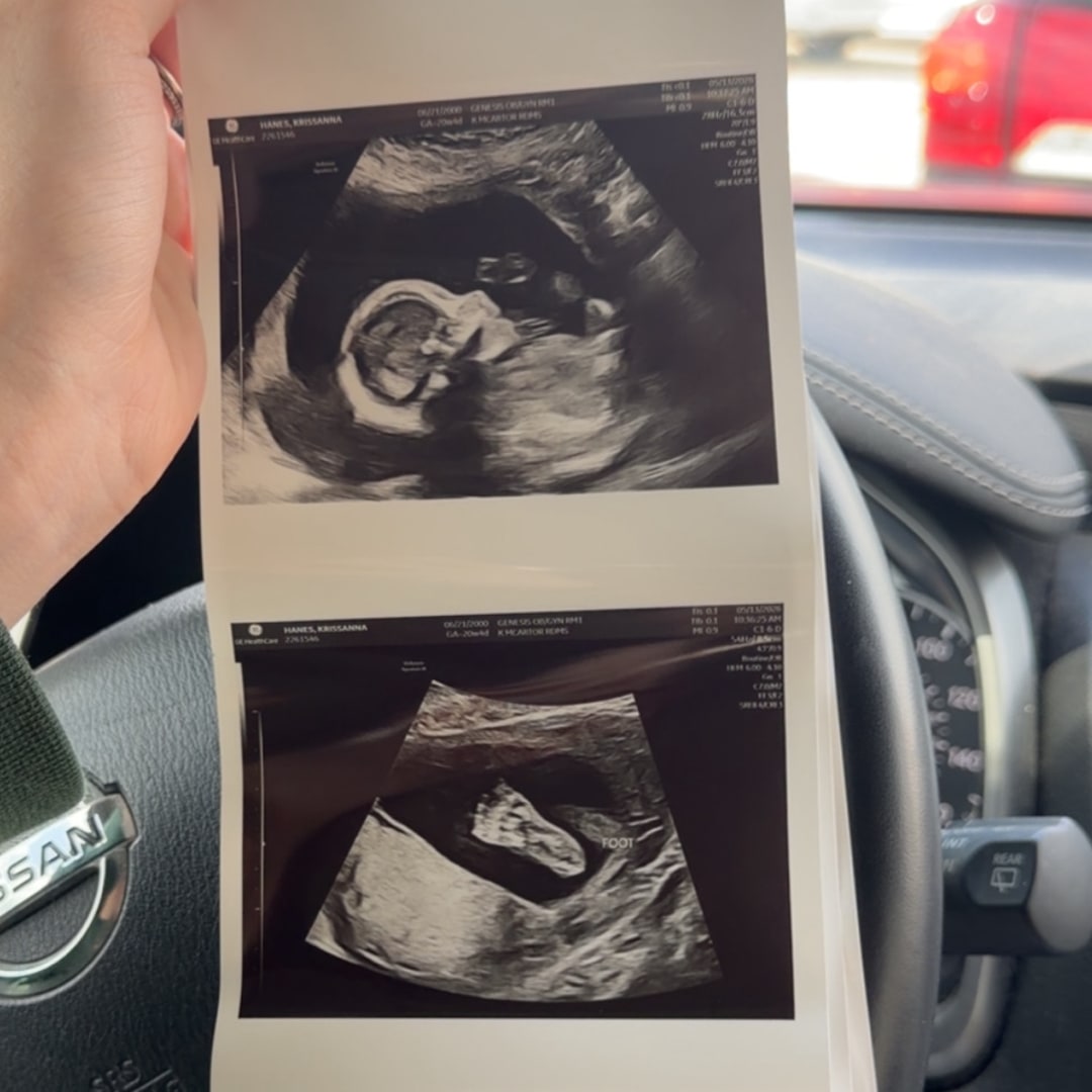 Photo shared by Krissanna for their Babylist baby registry.