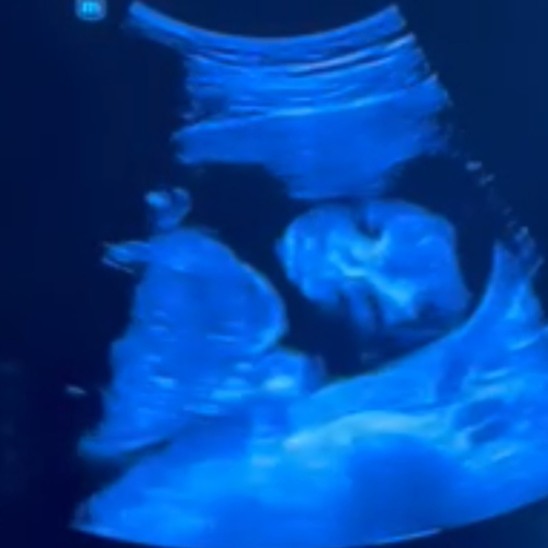 Photo shared by Breeze for their Babylist baby registry.