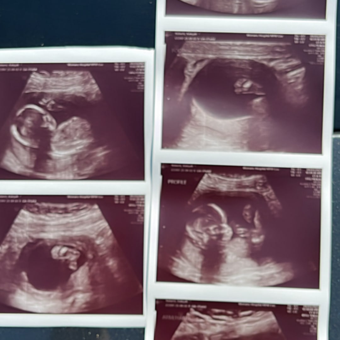 Photo shared by Ka’Leyah for their Babylist baby registry.
