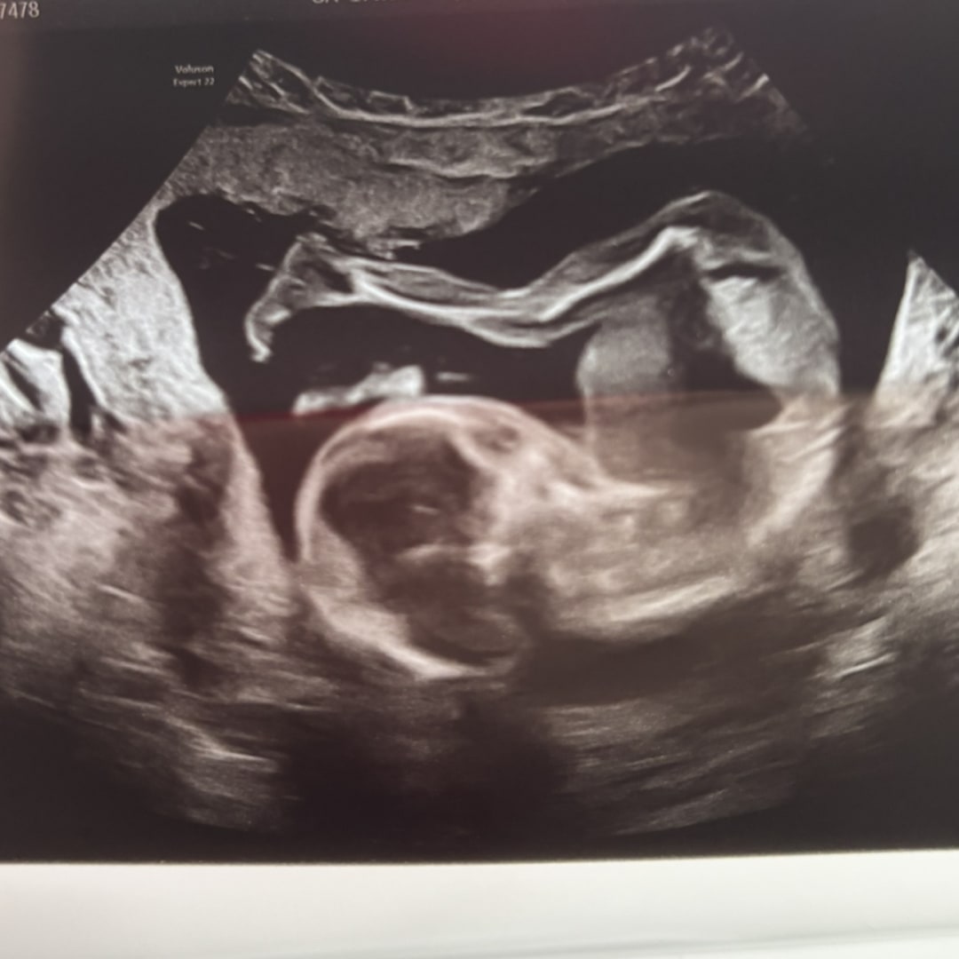 Photo shared by Abbie for their Babylist baby registry.